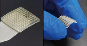PolyU develops wearable microneedle patch to empower conventional ultrasound for continuous glucose monitoring