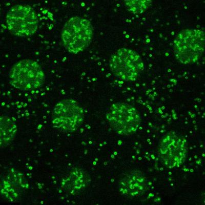 Histones in Fruit Fly Embryo