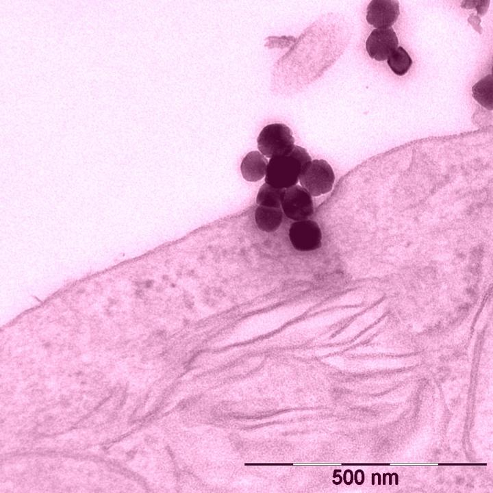 Iron Oxide Nanoparticles
