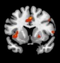 Brain Activations