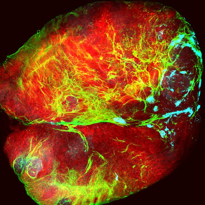 <i>Drosophila</i> Tumor