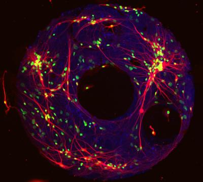 Zeringue Cell Model