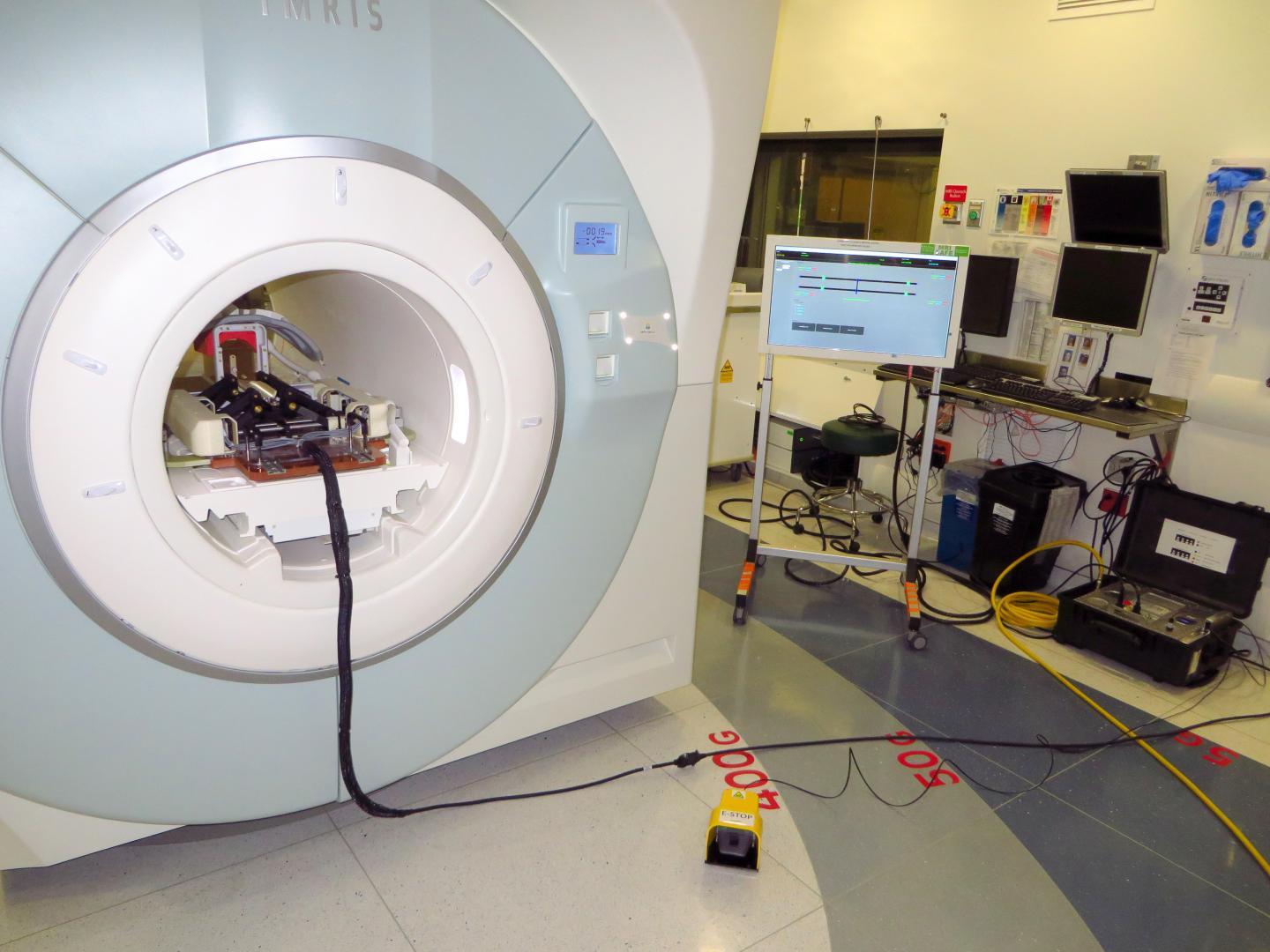 Overview of MRI-Compatible Prostate Biopsy Robot