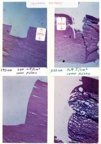 Micrographs of Human Aorta