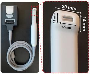 Toothbrush-shaped ultrasound allows for gum monitoring