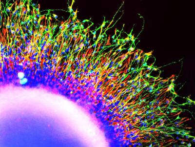 Neural Progenitor Cells in Migration Assay (1 of 2)