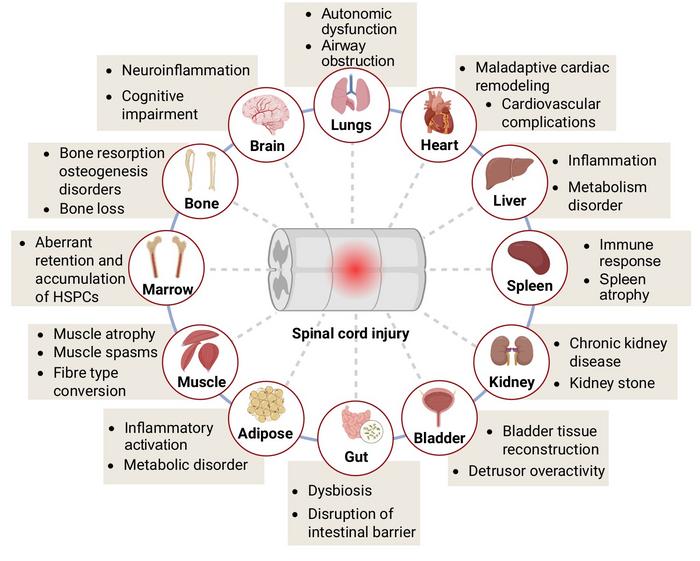 Spinal cord injury induces multi-organ dysfunction throughout the body via a "neuro-immune-metabolic network."