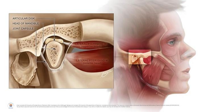 Illustration of the temporomandibular joint (TMJ)