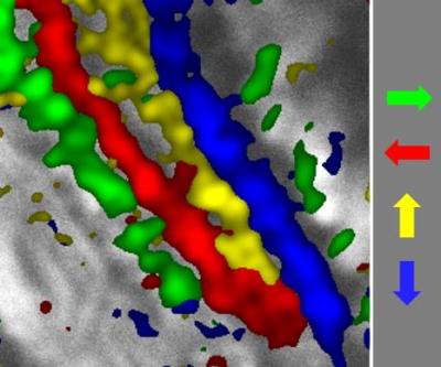 Brain <i>Drosophila</i>
