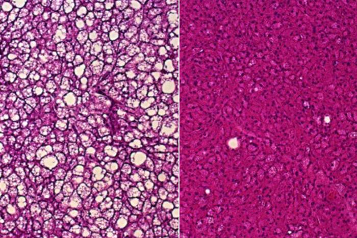 Novel way to ‘rev up’ brown fat burns calories, limits obesity in mice