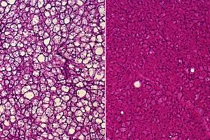 Novel way to ‘rev up’ brown fat burns calories, limits obesity in mice