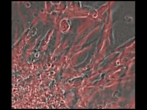 Heart Tissue Beating in a Dish