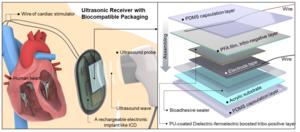 [Figure 2] Conceptual overview and internal schematic of the device