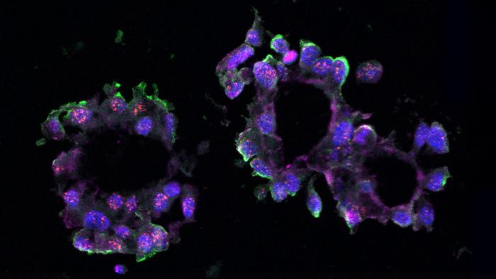 TNBC organoid