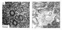 Axons -- Normal and Abnormal