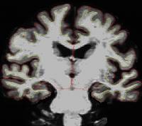 SuperAger Brain