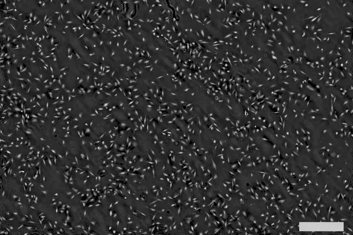 Glioblastoma cells