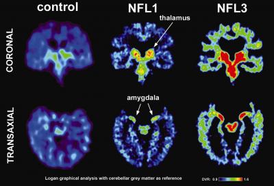 Brain Scans