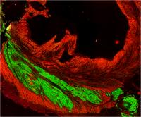 Implanted Cardiac Cell Graft