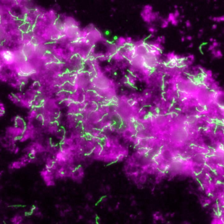 Immunofluorescence Microscopy of <em>B. Burgdorferi</em>