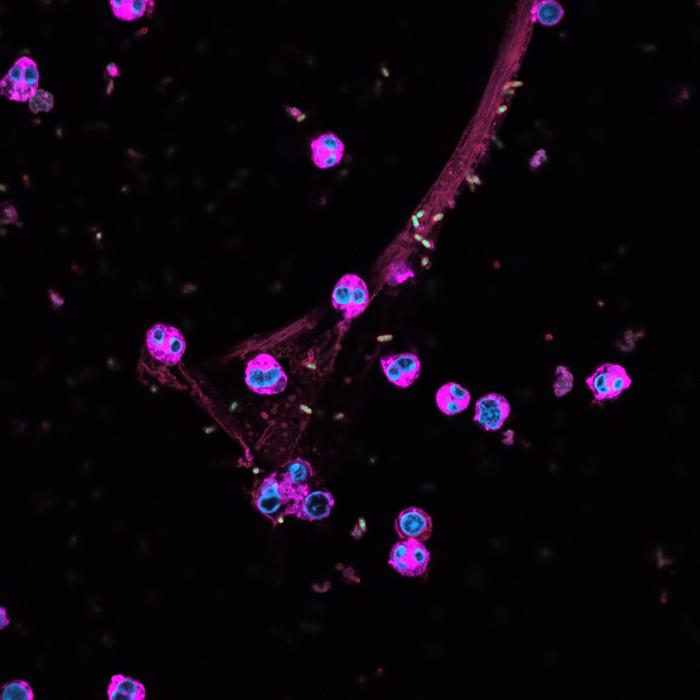 Immune cells (pink) cast out web-like nets (red) that trap bacteria (green).