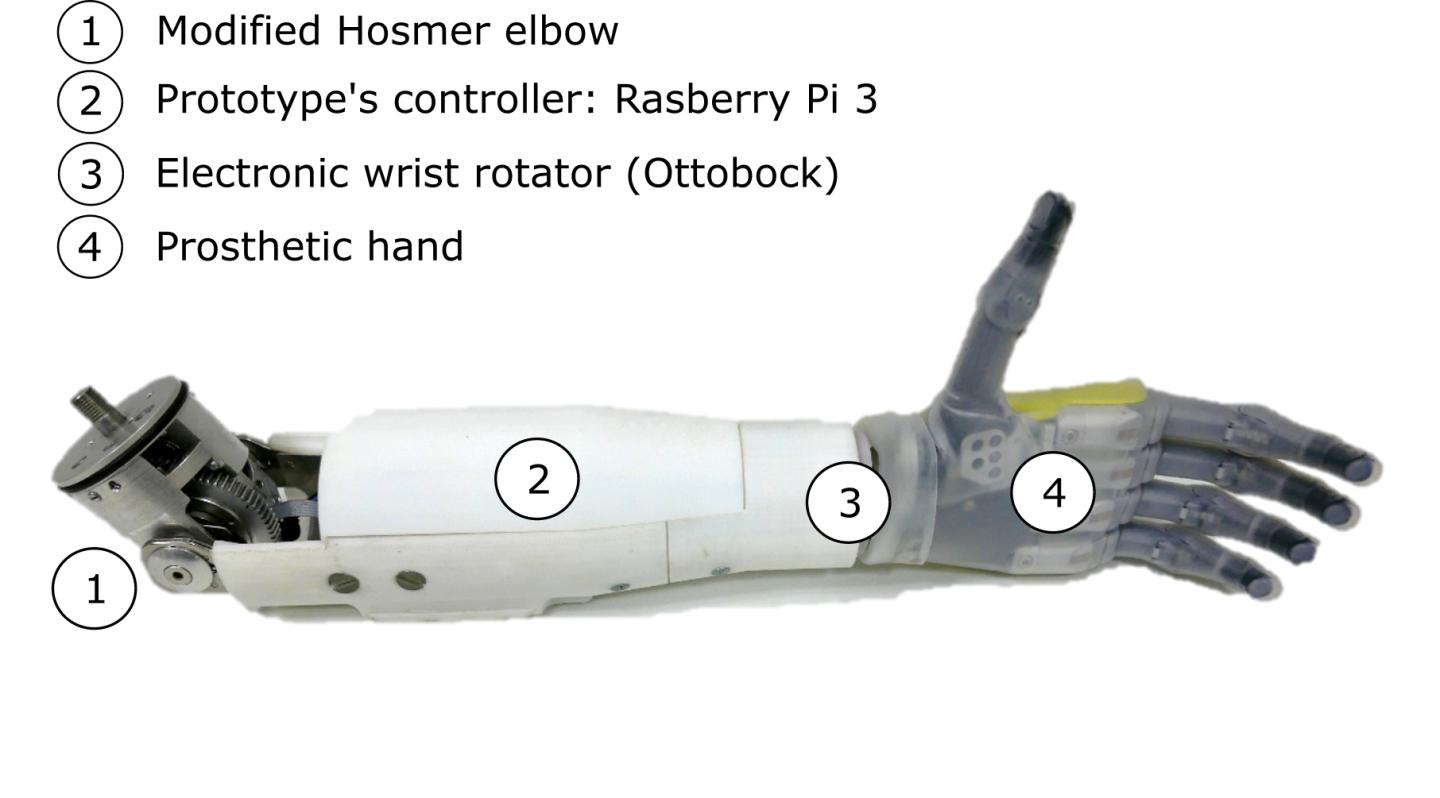 The Arm Prosthesis
