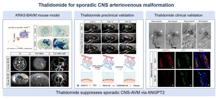 Thalidomide for sporadic CNS arteriovenous malformation