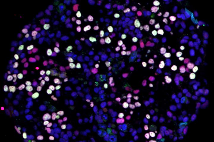 Differentiating Human Pluripotent Stem Cells