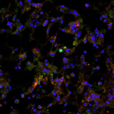 Lung Cells