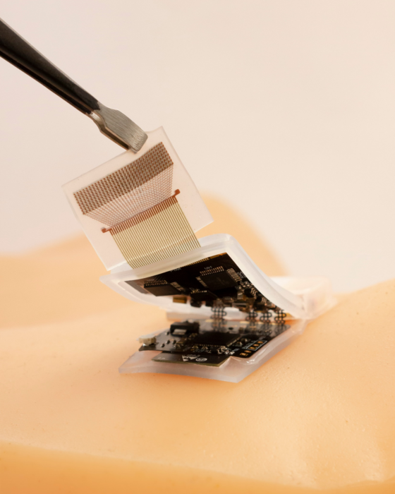Wireless ultrasound patch 2