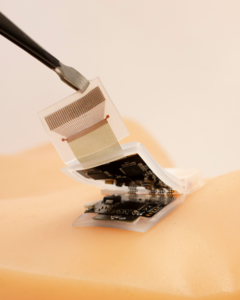 Wireless ultrasound patch 2