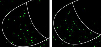 VMHVL Picture from Male Mouse Brain