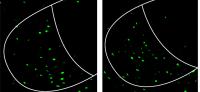 VMHVL Picture from Male Mouse Brain
