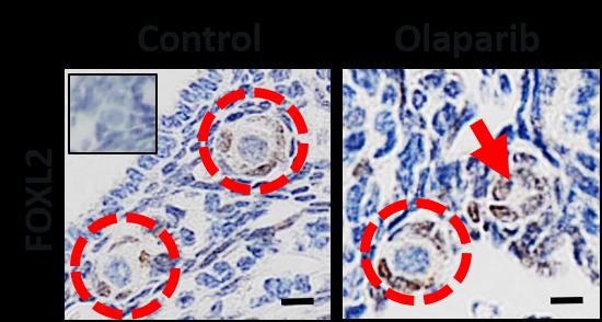 Breast Cancer Drug, Olaparib, Depletes Store of Immature Eggs in Mouse Ovaries