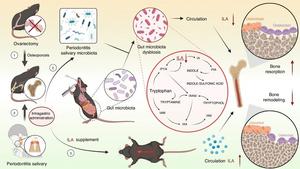 Oral–Gut–Bone Axis Linking Periodontitis to Osteoporosis