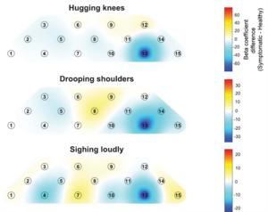 Same “Depressed” Body Movements, Opposite Brain Responses: KAIST Study Reveals Differences by Depressive Symptom Level