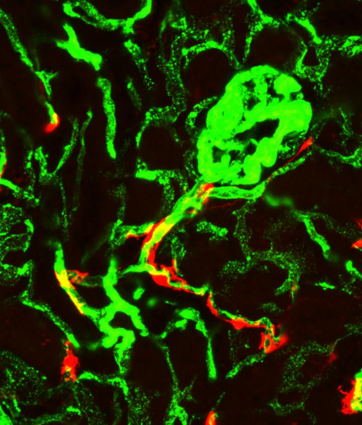 Locating the Cells that Give Rise to Scar Tissue