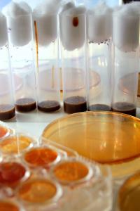Fruit Flies and Gut Bacteria Vertical
