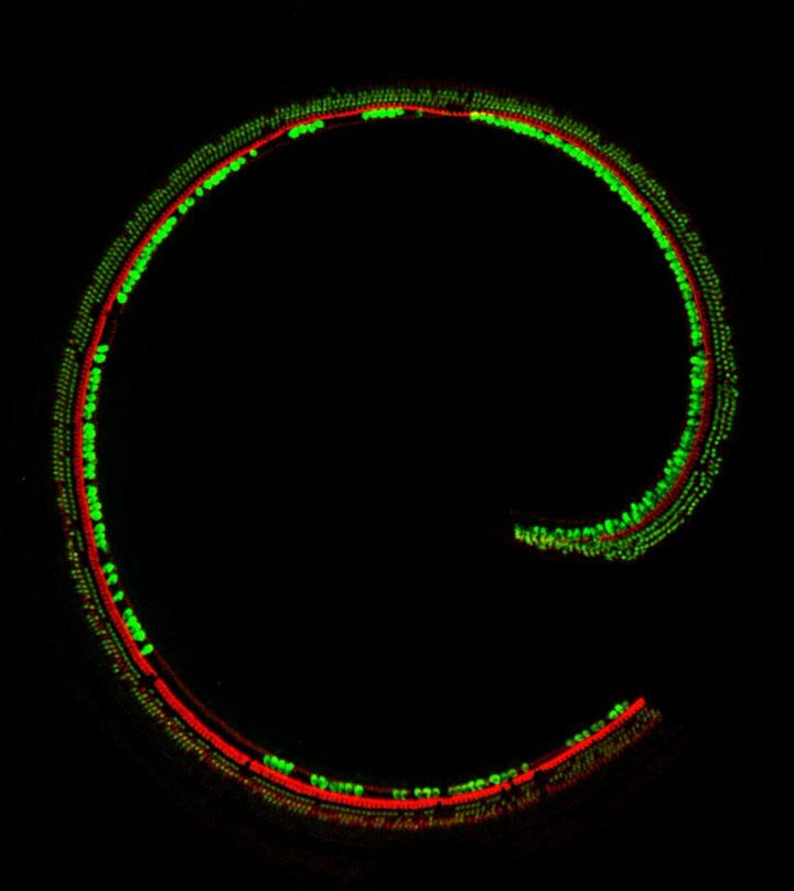 Cochlea with Sensory Hair Cells