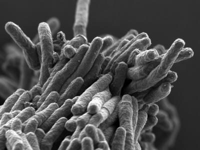 <I>Mycobacterium tuberculosis</I>