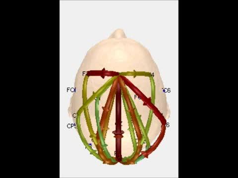 Brain Activity