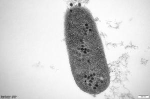 Phages attacking bacteria under the microscope