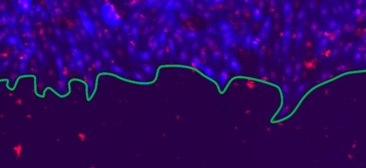 A physics perspective on wound healing