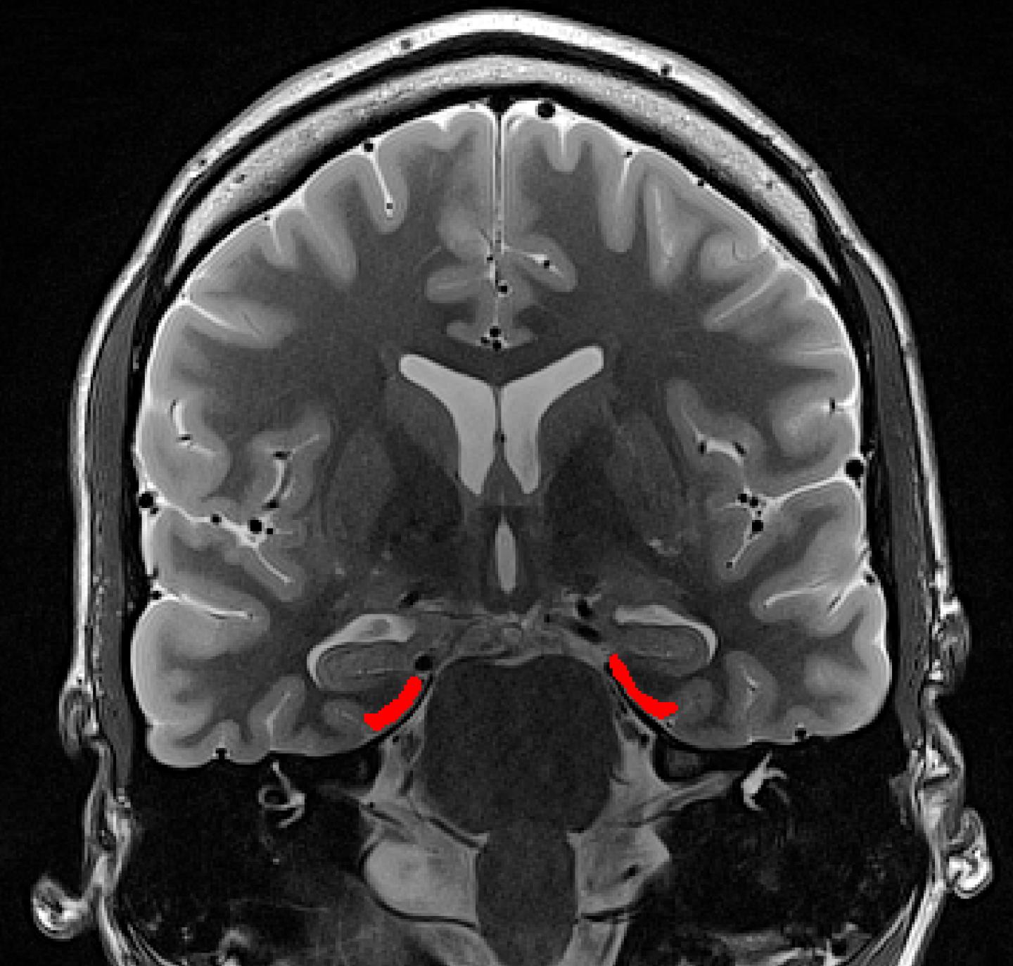 View Into the Human Brain (Mr Image)