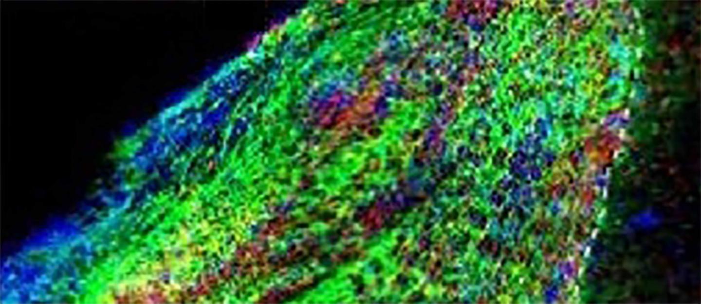 Repairing a Damaged Brain