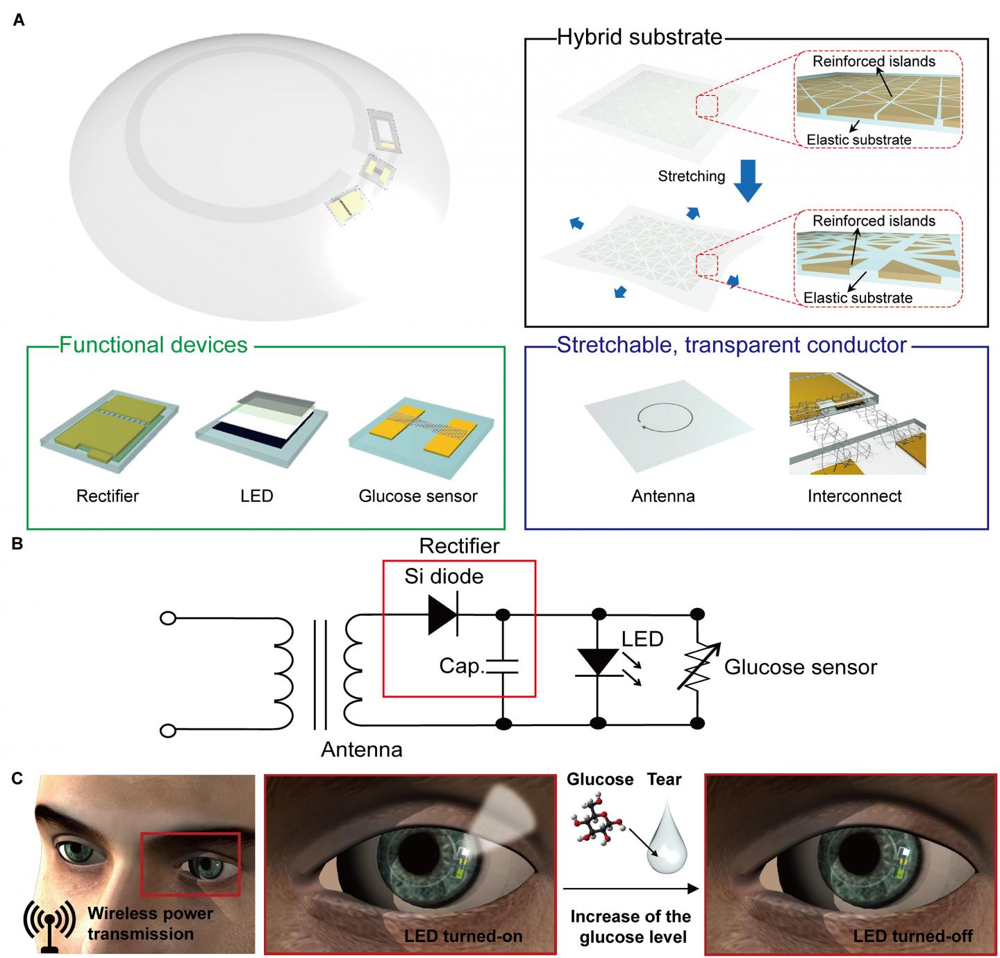 'Smart' Contact Lenses Monitor Glucose Levels in Tears (2 of 4)