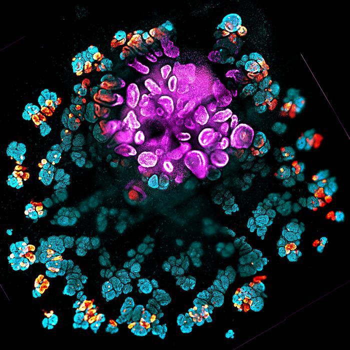 Kidney organoid