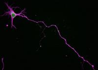 Normal Neuron