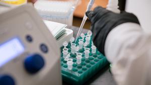 Gladstone's retron-based genome editing technology