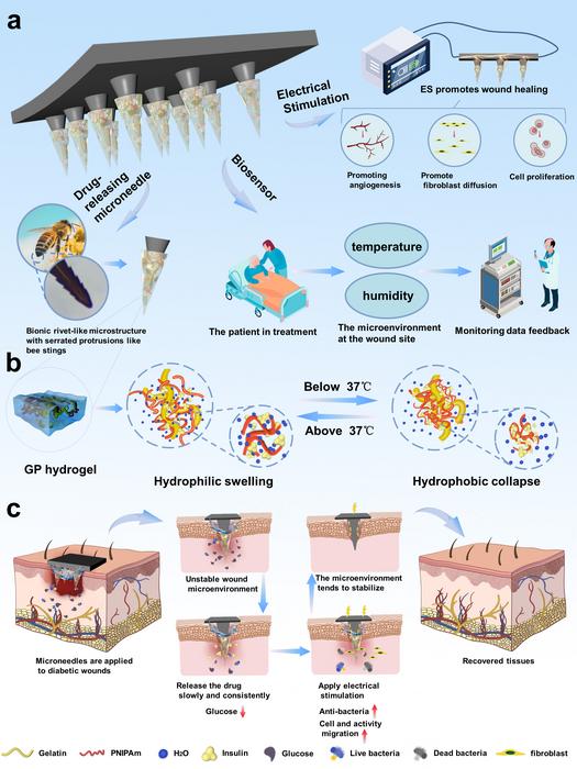 A temperature-sensitive GP-PPy/PLA-MN electroactive platform with smart and precise drug release, electrostimulation transmission, and real-time wound assessment monitoring